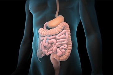 Colon Resection