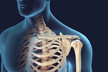 Shoulder Replacement