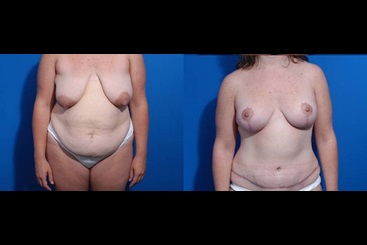 Cosmetic Medicine and Surgery at Mercy