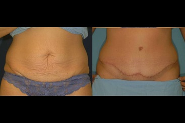 Cosmetic Medicine and Surgery at Mercy