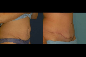 Cosmetic Medicine and Surgery at Mercy