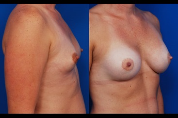 Cosmetic Medicine and Surgery at Mercy