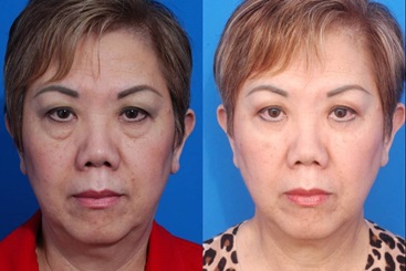 Cosmetic Medicine and Surgery at Mercy