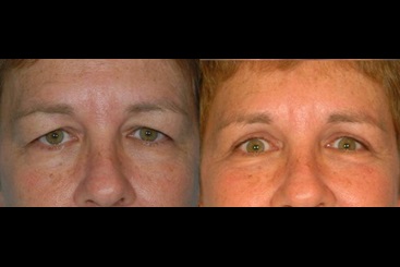 Cosmetic Medicine and Surgery at Mercy