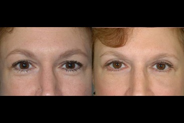 Cosmetic Medicine and Surgery at Mercy