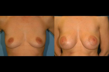 Cosmetic Medicine and Surgery at Mercy