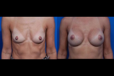 Cosmetic Medicine and Surgery at Mercy