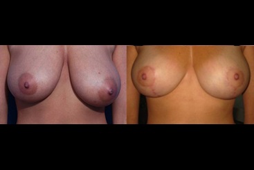 Cosmetic Medicine and Surgery at Mercy